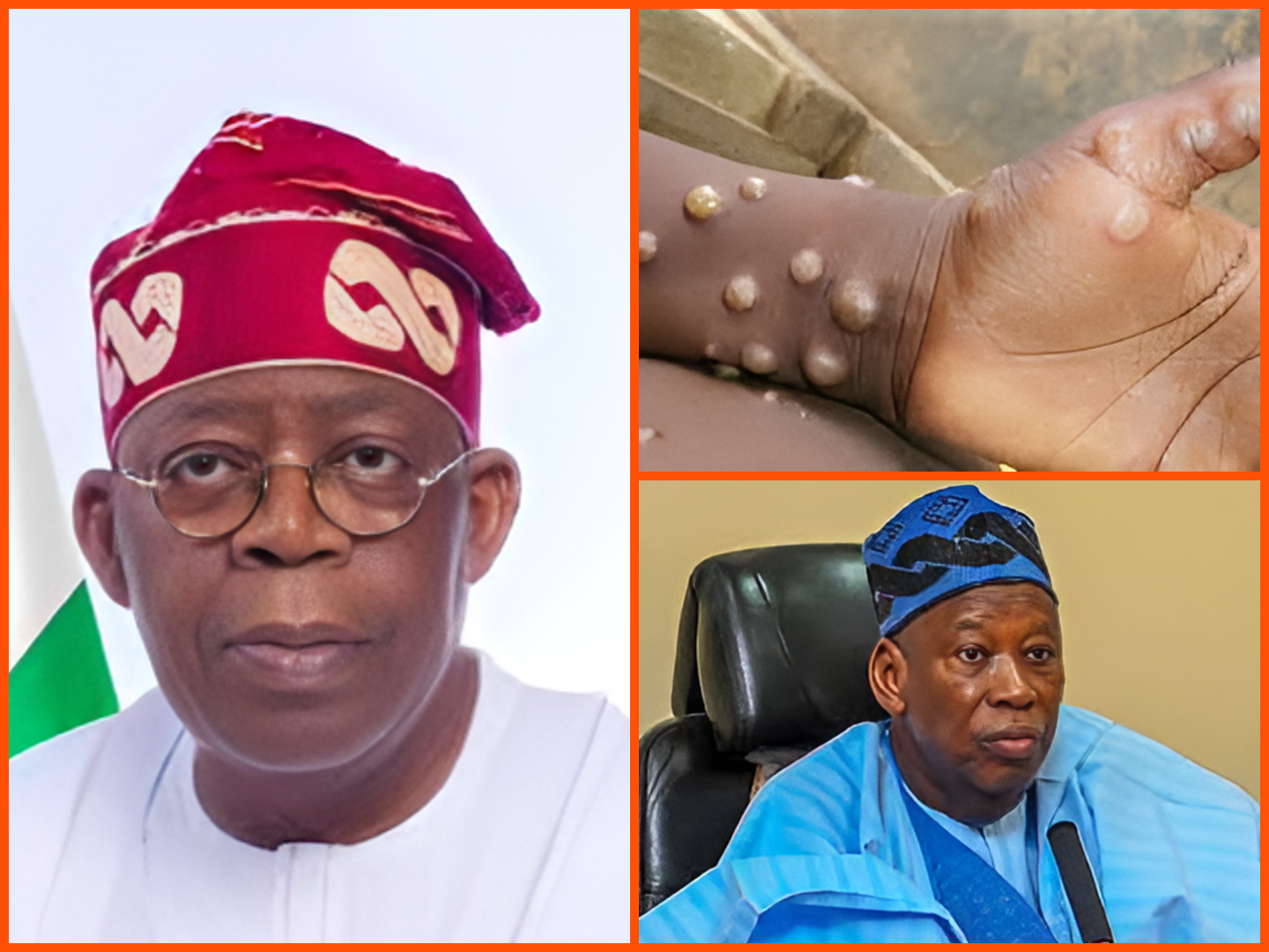 Top news today are: FG tightens border surveillance as Mpox cases increase and Afe Babalola said FG has turned Nigerians into beggars through palliatives.